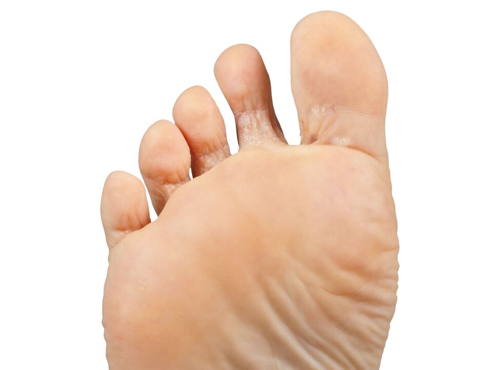 Funer-and-pair-and-hectic-cream demyxil