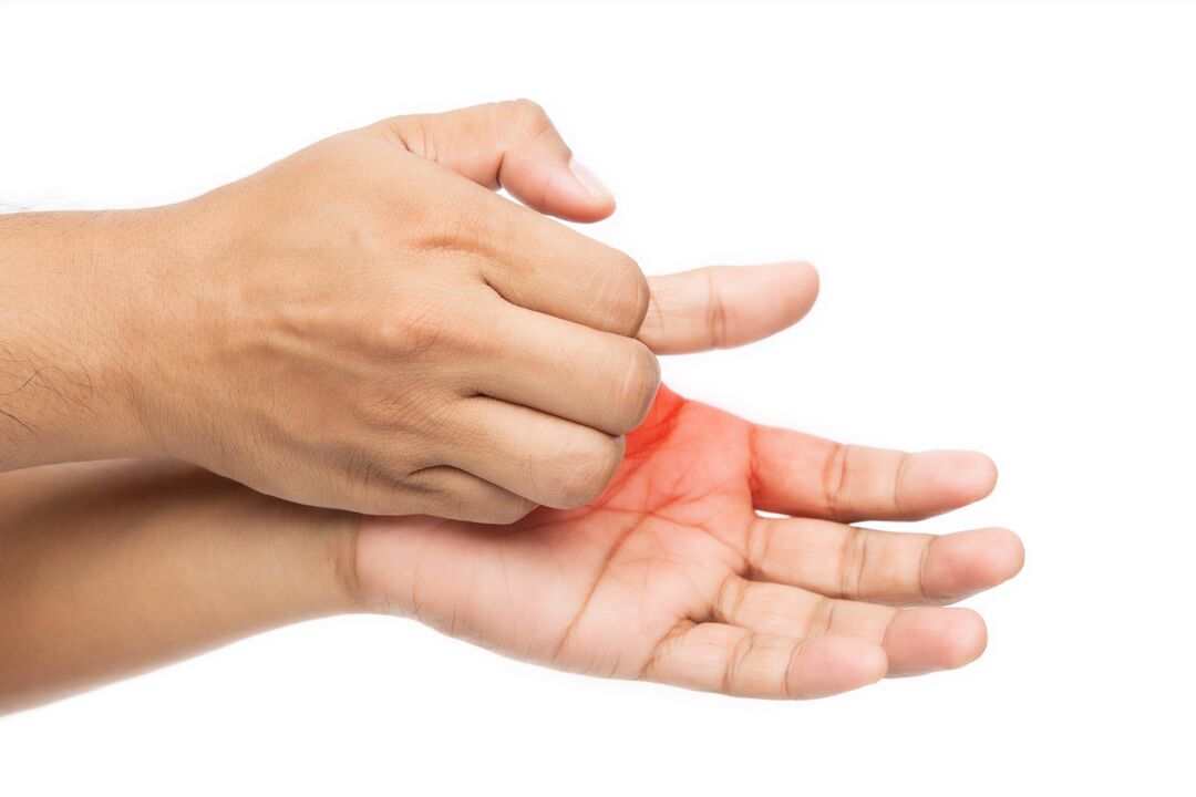 Itching with a fungus and its treatment with Demyxil -CREEN with cream