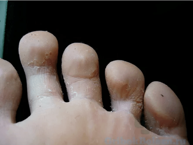 The phases of the mushroom