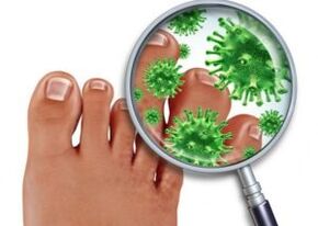 Methods for treating fungus on toenails